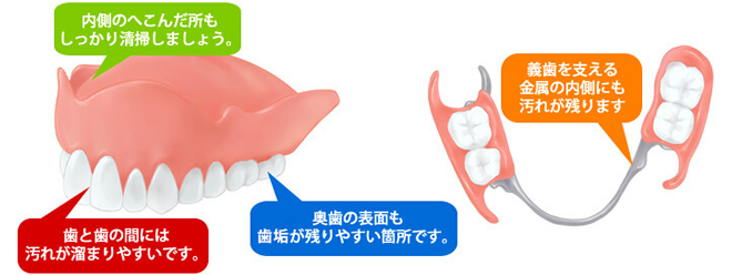 入れ歯の清掃について