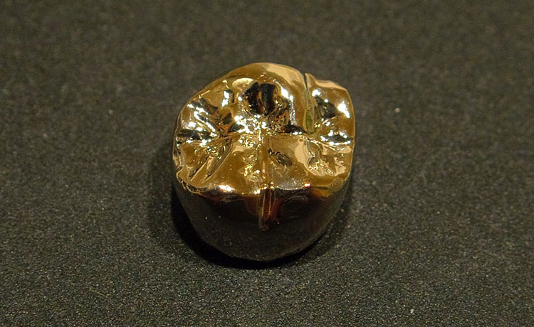 ゴールドクラウン